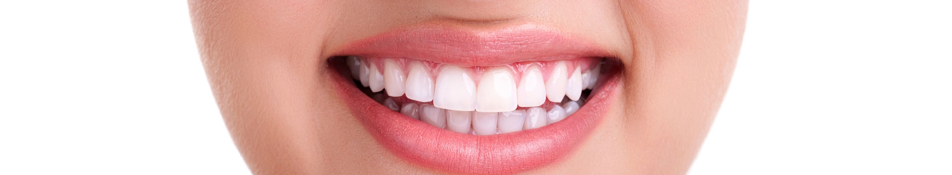 5 questões respondidas sobre Lentes de Contato Dental