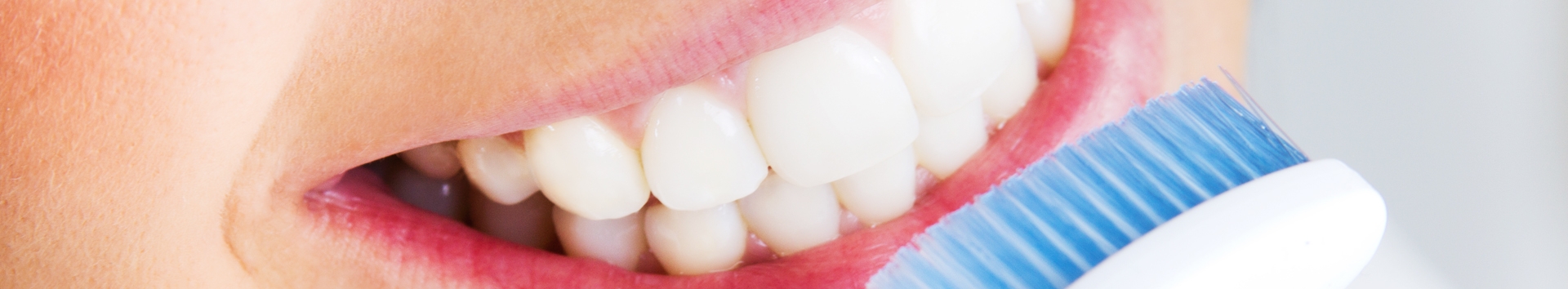 Clareando os dentes em casa: Como um dentista orienta?