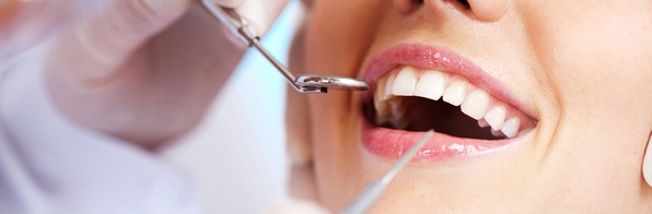 Odontologia - Como evitar infecção cruzada com a esterilização de materiais