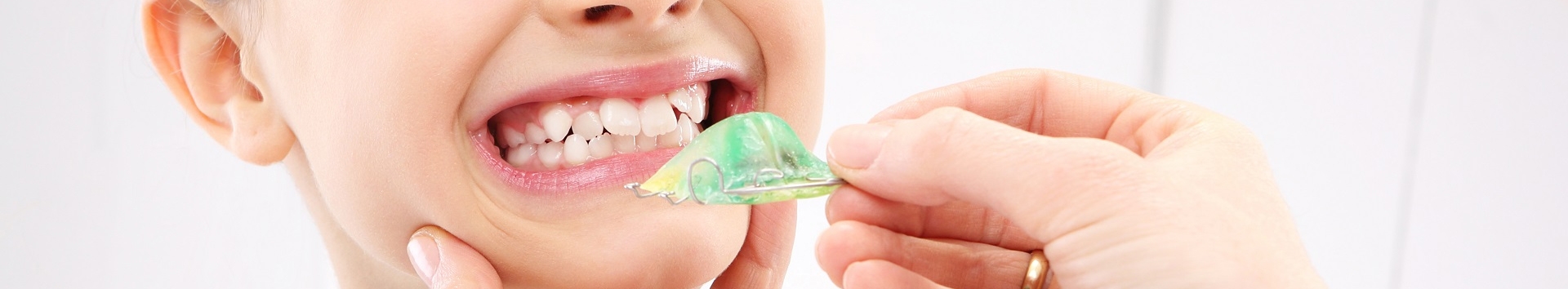 Dentes tortos: O que fazer? Fatos e lendas sobre doenças