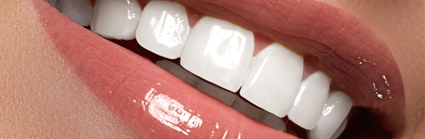 Odontologia - Lente de Contato Dental: Como escolher a melhor Clínica