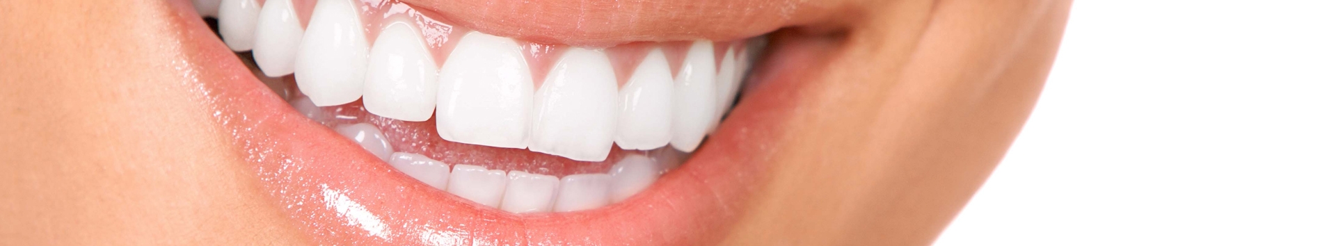 O que é coroa dentária? Tipos, benefícios e melhores preços