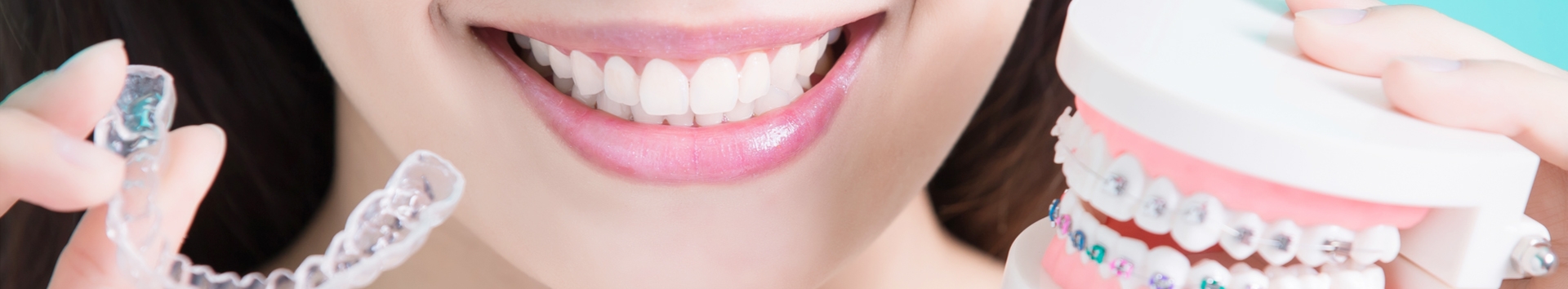 O que é Ortodontia convencional, estética, lingual e preventiva?