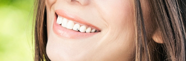Odontologia - PIERCING DENTAL: VEJA OS RISCOS E CUIDADOS QUE VOCÊ DEVE TOMAR