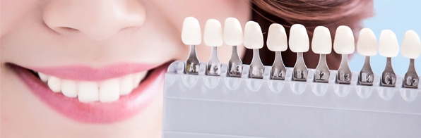 Odontologia - Procura por lentes de contato dental aumenta cada vez mais