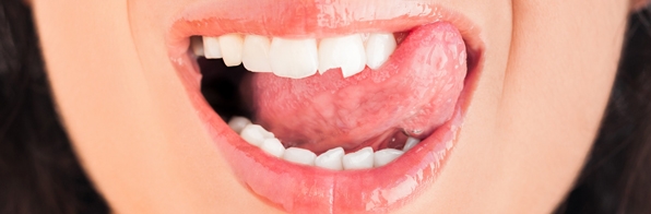 Odontologia - Quebrei o dente, e agora? Restauração Dentária é a sua salvação