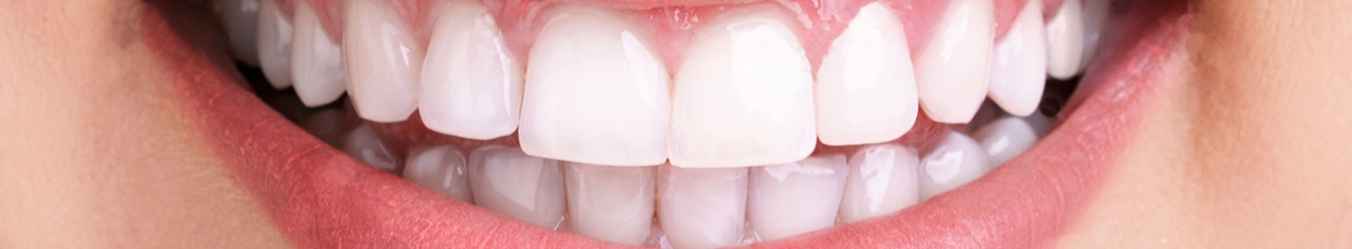 Raspagem periodontal: 5 questões essenciais sobre o tratamento