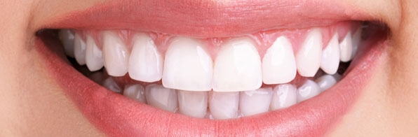 Odontologia - Raspagem periodontal: 5 questões essenciais sobre o tratamento